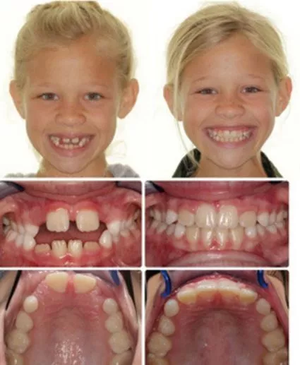 girl before & after